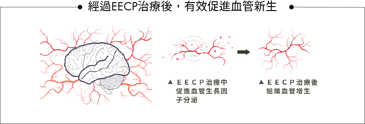 EECP療程促進血管新生，透過刺激血管生長因子分泌，最終達到組織血管增生的效果。